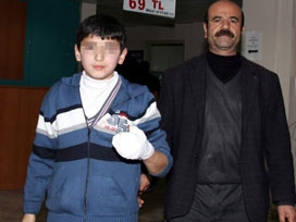 Oynadığı cisim elinde patladı